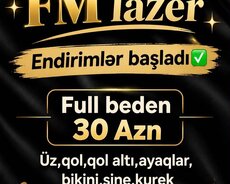 Lazer epilyasiya xidməti 30